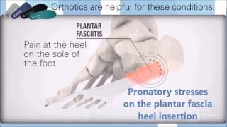 Compleet Feet Educational Orthotic Video  .......... + barking dog!