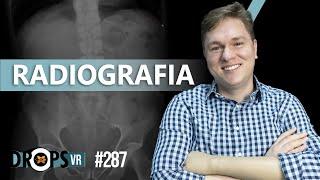 RADIOGRAFIA - COMO FUNCIONA?