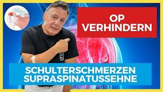 Supraspinatussehne ️ Hilfe bei Schulterschmerzen - OP VERHINDERN!