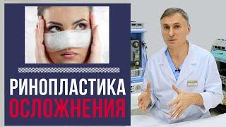 РИНОПЛАСТИКА: Осложнения | Чего бояться пациенту?