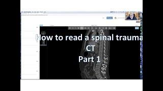 How to read a spinal trauma CT Part 1.