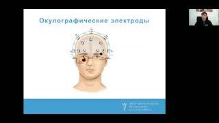 Опыт использования дополнительных электродов при продолженном видео-ЭЭГ мониторинге. Троицкий А.А.