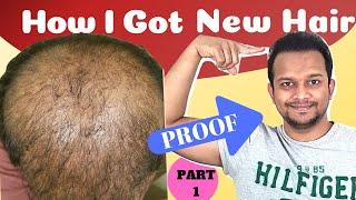 Regrow Hair In 2021, Tried N Tested Working Remedies For Hair Regrowth | Stop Hair Fall And Baldness