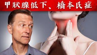 甲狀腺低下,九成是橋本氏甲狀腺炎,自然療法,柏格醫生 Dr Berg