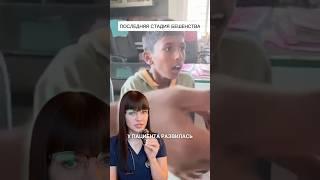 БЕШЕНСТВО, последняя стадия