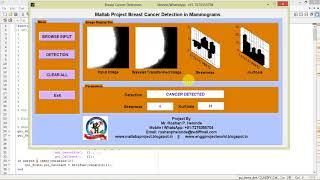 Matlab Project Breast Cancer Detection in Mammograms using Image Processing Full Source Code