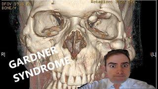 Syndrome Series: Gardner Syndrome