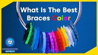 What are the BEST Braces Colors? | Braces Color Ideas