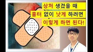 배현 약사 [링거TV] 셀프메디케이션 하기 - 상처 났을 때 가장 먼저 쓰는 치료법!