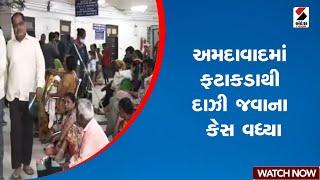 અમદાવાદમાં ફટાકડાથી દાઝી જવાના કેસ વધ્યા | Ahmedabad | Civil Hospital | Diwali | Gujarat