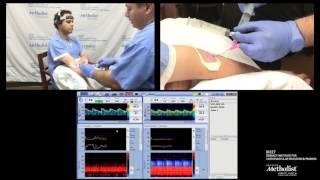 TCD BUBBLE TEST for Cardiac Shunt Detection PFO TEST (Zsolt Garami, MD)