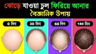 চুল ঝোড়ে যাওয়ার হাত থেকে বাচতে অবশ্যই দেখুন | How To Prevent Hair Fall Without Wasting Money