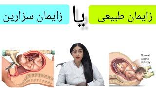 زایمان طبیعی بهتره یا زایمان سزارین؟ / مقایسه دو روش/ معایب و فواید هر دو روش طبیعی و سزارین