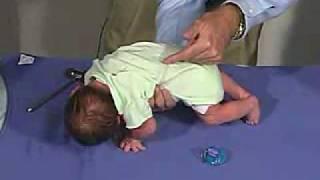 physical exam -Newborn Normal: Primitive Reflexes - Galant