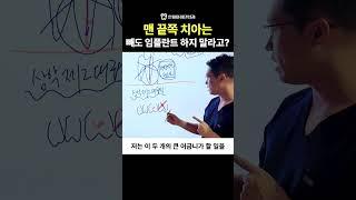 맨 끝쪽 치아는 빼도 임플란트 하지 말라고?