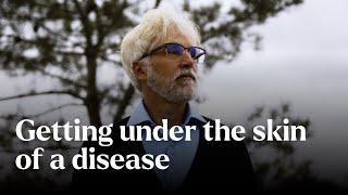 Getting under the skin of a disease - Nature's Building Blocks | BBC StoryWorks