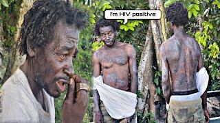 This Man is suffering from unknown Disease! Mental health ￼deplorable living condition’s |Jamaican