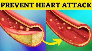 FEAR OF HEART ATTACK?! UNCLOG Arteries with These Superfoods!