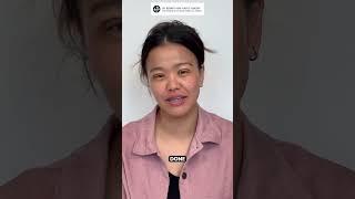 Transformation Complete: Double Eyelid Surgery with Dr. Kenneth Kim | Patient Testimonial