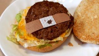 BAND-AID ON FAST FOOD BURGER!