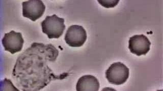 Crawling Neutrophil Chasing a Bacterium