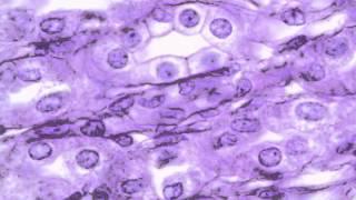 Chapter 5   Epithelium vs  Connective Tissue