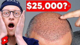 How Much Does a Hair Transplant Cost? #Shorts