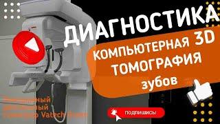Компьютерная томография 3D в стоматологии