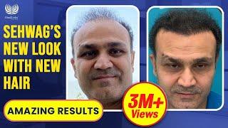 Virender Sehwag's Hair Transplant Results 2024 | Cricketer/Celebrity Hair Transplant In India