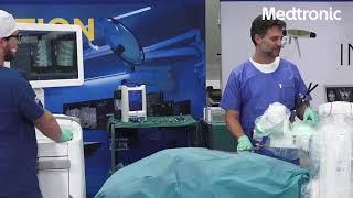 Understand how the Mazor X Stealth Edition ™ is transforming spinal workflow with an expert surgeon.