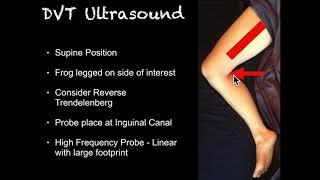 POCUS -  Right Lower Extremity Deep Venous Thrombosis (DVT)