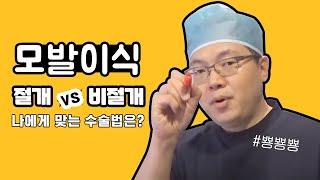 #모발이식 방법이 따로 있다고요?  I 절개vs비절개 선택은? I 한나이브성형외과