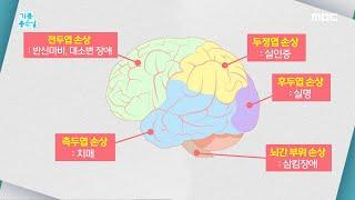 [기분 좋은 날] 무시하면 평생 장애 얻는다? '뇌경색 후유증'의 모든 것!, MBC 210629 방송