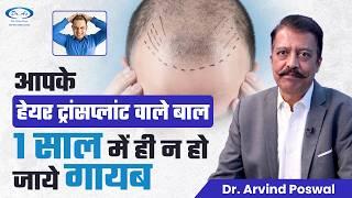 What is the Life Expectancy of Transplanted Hair? | Dr. Arvind Poswal, Best Hair Transplant in Delhi