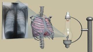 History of Computerized Tomography (CT Scanner)