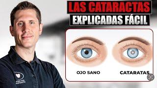  ¿Que son las CATARATAS de TUS OJOS?