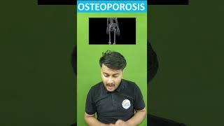 Osteoporosis Causing Drugs ‍#gpat2024 #pharmacology