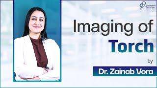 imaging of torch by Dr. Zainab Vora | Conceptual Radiology | Radiology Residency