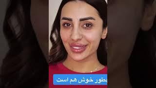 Farzana naaz lip filler #afghanistan #afghani #reelsinstagram #shortvideo #afghan #aryanasayeed #sho