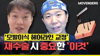 모발이식 헤어라인 교정 재수술할 때, 가장 중요한 '이것'│모벤져스