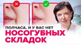 Как убрать носогубные складки. Убираем носогубки в кабинете у косметолога | Ирина Рахова