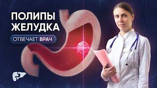 Полипы желудка: причины, диагностика и лечение