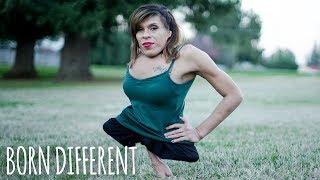 Trans Woman Born With Half A Body Finds Love | BORN DIFFERENT