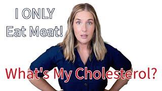 My cholesterol after eating only meat for 6 years!! +other metabolic blood markers!