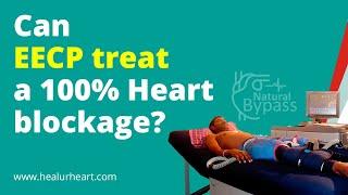 Can EECP treat a 100%  Heart blockage?