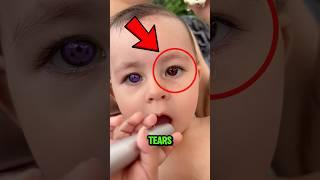 How This TEARS Look Under The Microscope‼️