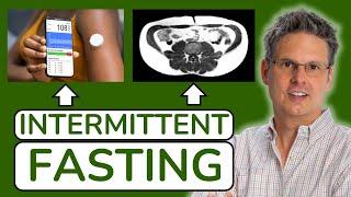 Intermittent Fasting: Effects on Body Weight and Blood Sugar Regulation