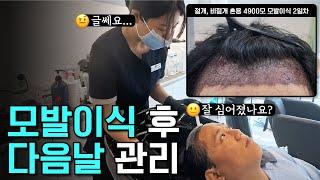 모발이식 후 방심하면 심은 머리 다 빠집니다! 모발이식 수술 2일차  | 탈탈극장 3부