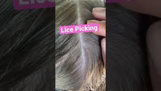 Lice Picking  l Pulling Small Louse Out of Hair  l Lice Removal Service @staceythelouselady