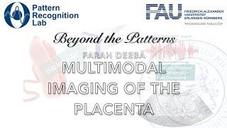 Beyond the Patterns 49 - Farah Deeba – Multimodal Imaging of the Placenta